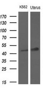 TNFRSF10A Antibody in Western Blot (WB)