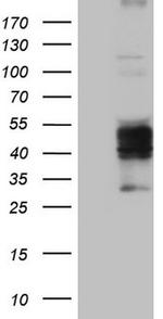 TNFRSF10A Antibody in Western Blot (WB)