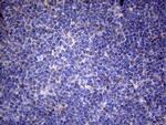 TNFRSF10B Antibody in Immunohistochemistry (Paraffin) (IHC (P))