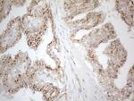 TNFRSF10B Antibody in Immunohistochemistry (Paraffin) (IHC (P))