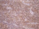 TNFRSF10B Antibody in Immunohistochemistry (Paraffin) (IHC (P))