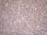 TNFRSF10B Antibody in Immunohistochemistry (Paraffin) (IHC (P))