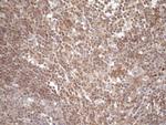 TNFRSF10B Antibody in Immunohistochemistry (Paraffin) (IHC (P))