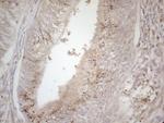 TNFRSF10B Antibody in Immunohistochemistry (Paraffin) (IHC (P))