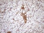 TNFRSF10B Antibody in Immunohistochemistry (Paraffin) (IHC (P))