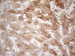 TNFRSF10B Antibody in Immunohistochemistry (Paraffin) (IHC (P))