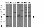 TNFRSF10B Antibody in Western Blot (WB)