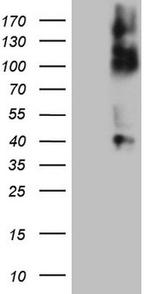 TNFRSF14 Antibody in Western Blot (WB)