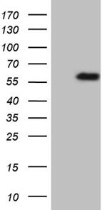 TNFRSF19 Antibody in Western Blot (WB)