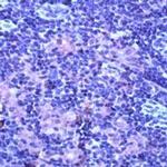 TNFR2 Antibody in Immunohistochemistry (Paraffin) (IHC (P))