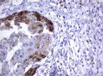 TNFRSF8 Antibody in Immunohistochemistry (Paraffin) (IHC (P))