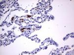 TNFRSF8 Antibody in Immunohistochemistry (Paraffin) (IHC (P))