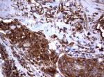 TNFRSF8 Antibody in Immunohistochemistry (Paraffin) (IHC (P))