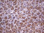 TNFRSF8 Antibody in Immunohistochemistry (Paraffin) (IHC (P))