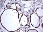 TNFRSF8 Antibody in Immunohistochemistry (Paraffin) (IHC (P))