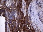 TNFRSF8 Antibody in Immunohistochemistry (Paraffin) (IHC (P))