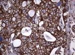 TNFRSF8 Antibody in Immunohistochemistry (Paraffin) (IHC (P))