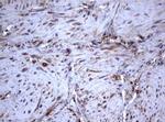 TNFRSF8 Antibody in Immunohistochemistry (Paraffin) (IHC (P))