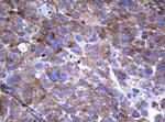 TNFRSF8 Antibody in Immunohistochemistry (Paraffin) (IHC (P))