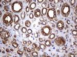 TNFRSF8 Antibody in Immunohistochemistry (Paraffin) (IHC (P))