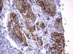 TNFRSF8 Antibody in Immunohistochemistry (Paraffin) (IHC (P))