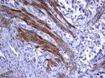 TNFRSF8 Antibody in Immunohistochemistry (Paraffin) (IHC (P))