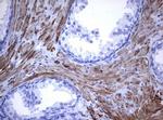 TNFRSF8 Antibody in Immunohistochemistry (Paraffin) (IHC (P))