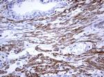 TNFRSF8 Antibody in Immunohistochemistry (Paraffin) (IHC (P))