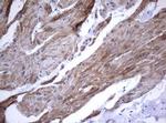 TNFRSF8 Antibody in Immunohistochemistry (Paraffin) (IHC (P))