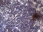 TNFRSF8 Antibody in Immunohistochemistry (Paraffin) (IHC (P))