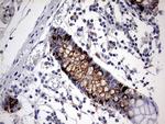 TNFRSF8 Antibody in Immunohistochemistry (Paraffin) (IHC (P))