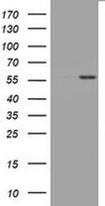 TNFRSF8 Antibody in Western Blot (WB)