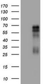 TNFRSF8 Antibody in Western Blot (WB)