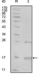 TNK1 Antibody in Western Blot (WB)