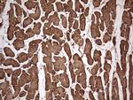 TNNC1 Antibody in Immunohistochemistry (Paraffin) (IHC (P))