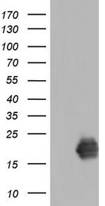 TNNC1 Antibody in Western Blot (WB)