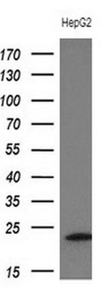 TNNI2 Antibody in Western Blot (WB)