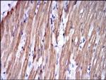 TNNI2 Antibody in Immunohistochemistry (Paraffin) (IHC (P))