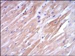 TNNI2 Antibody in Immunohistochemistry (Paraffin) (IHC (P))