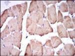 TNNI2 Antibody in Immunohistochemistry (Paraffin) (IHC (P))