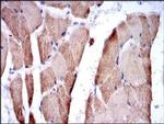 TNNI2 Antibody in Immunohistochemistry (Paraffin) (IHC (P))