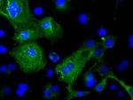 TNNI3 Antibody in Immunocytochemistry (ICC/IF)