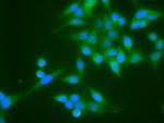 TNNI3 Antibody in Immunocytochemistry (ICC/IF)