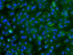 TNNI3 Antibody in Immunocytochemistry (ICC/IF)