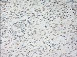 TNNI3 Antibody in Immunohistochemistry (Paraffin) (IHC (P))