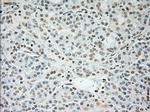 TNNI3 Antibody in Immunohistochemistry (Paraffin) (IHC (P))