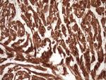 TNNI3 Antibody in Immunohistochemistry (Paraffin) (IHC (P))