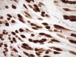 TNNI3 Antibody in Immunohistochemistry (Paraffin) (IHC (P))