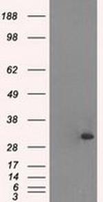 TNNI3 Antibody in Western Blot (WB)