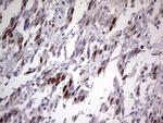 TNNT2 Antibody in Immunohistochemistry (Paraffin) (IHC (P))